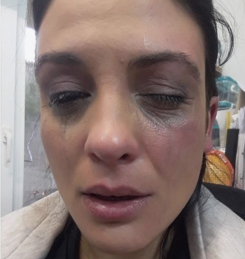 Актрисата от Откраднат живот Диана Димитрова е била жертва на насилие